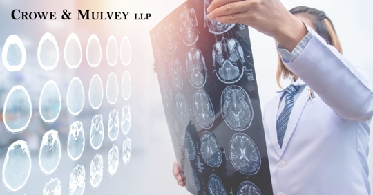 medical professional looking at brain scans