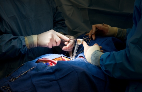 Cardiac Surgery
